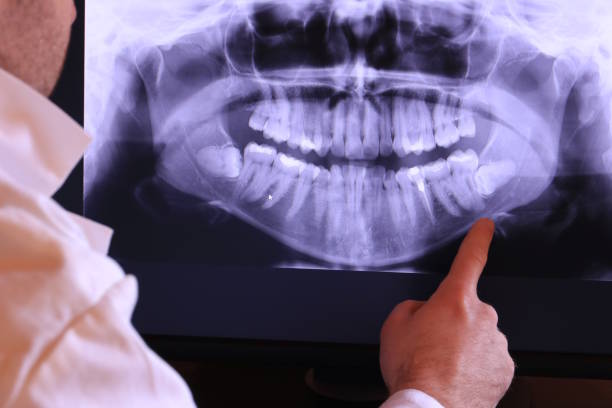 Best Emergency TMJ Treatment in New Haven, MO