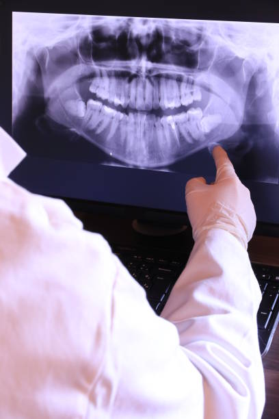 Best Urgent Care for Lost Fillings or Crowns in New Haven, MO