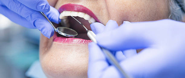 Best Urgent Care for Lost Fillings or Crowns in New Haven, MO